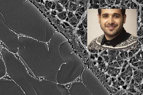 غضروف مصنوعی توسط محقق ایرانی تولید شد غضروف مصنوعی توسط محقق ایرانی تولید شد