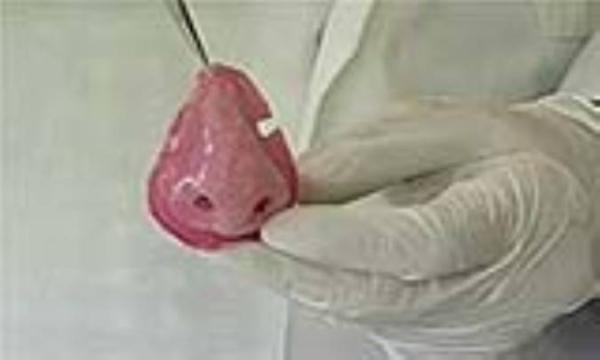 4 پیش بینی شگفت انگیز بینی 4 پیش بینی شگفت انگیز بینی